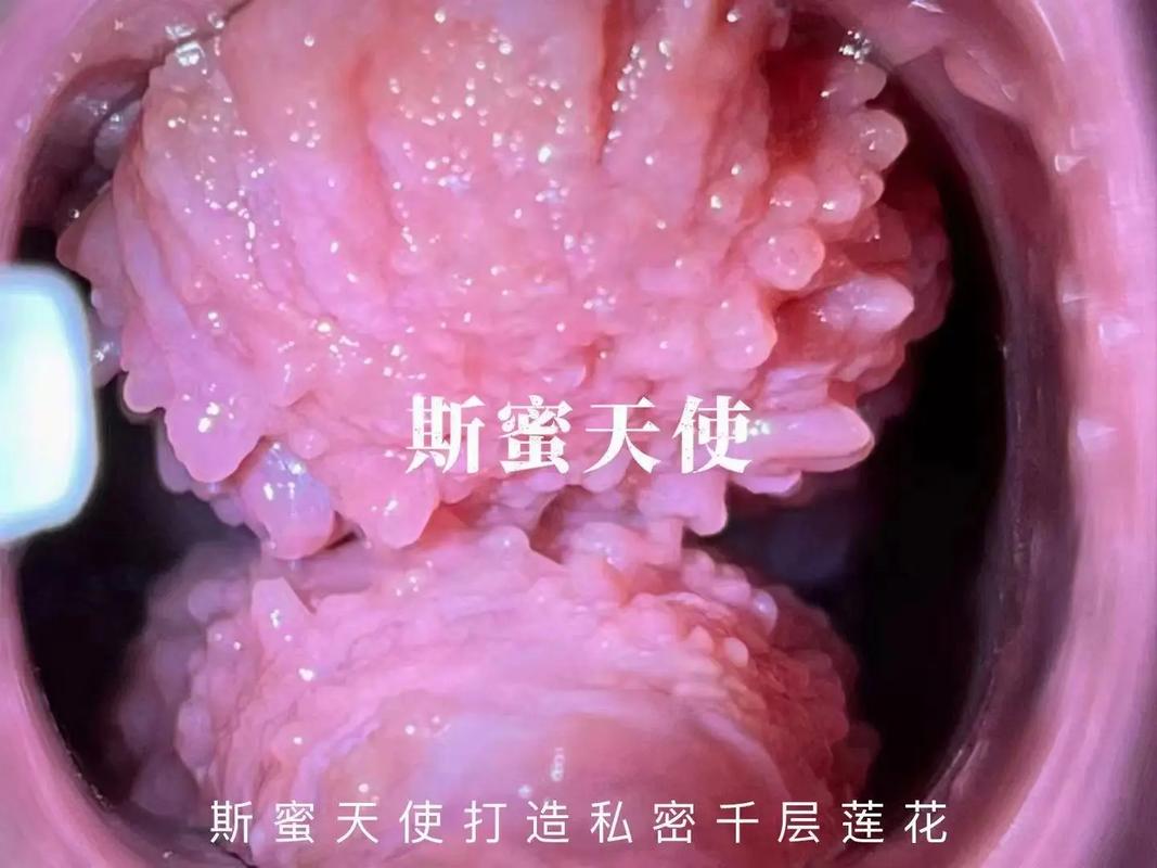 专业女性私密处破损修复产品,让您恢复如初